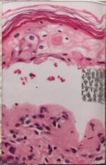 Derma – 1995